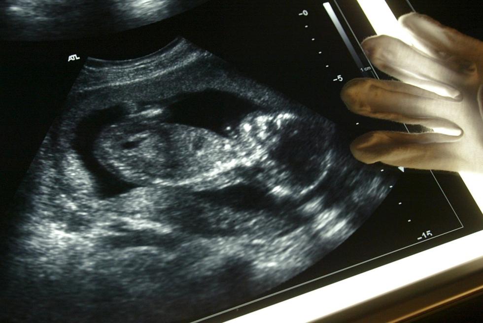 A glove lying on an ultrasound image