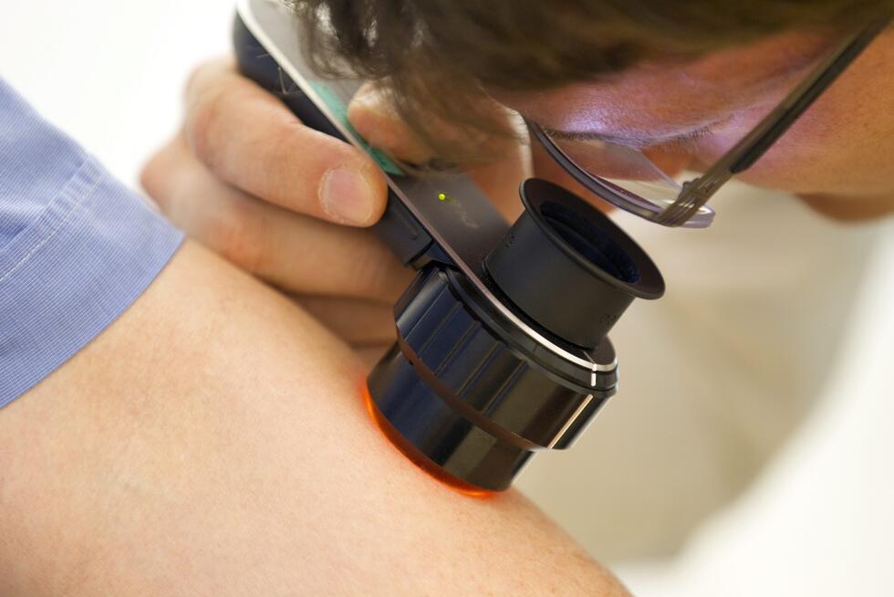 A doctor checking a patients skin for cancer